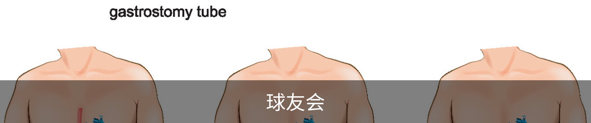 球友会